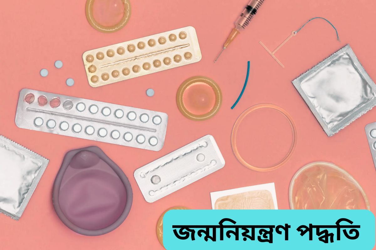 birth control method