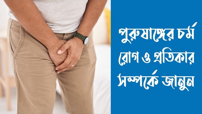পুরুষাঙ্গের চর্মরোগ