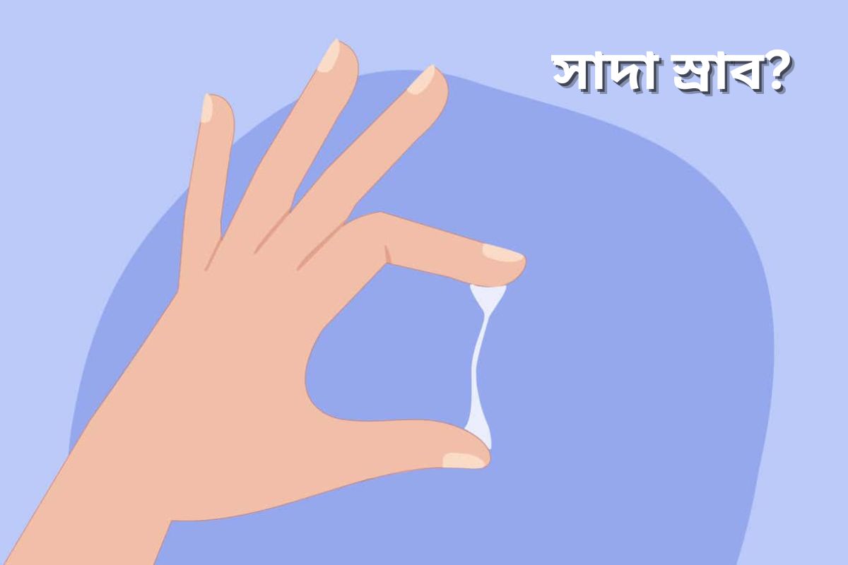 white discharge