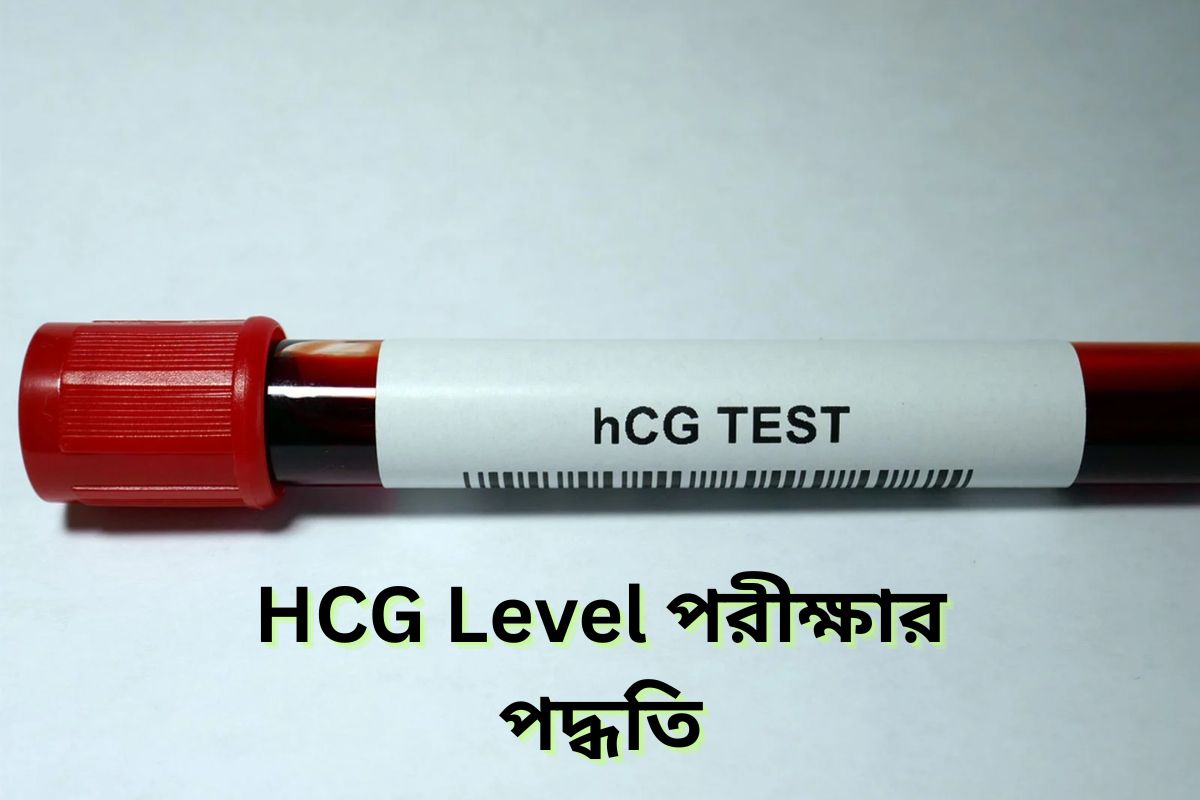 HCG Level Testing Method